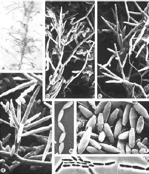 12 Figura 2 - Fusarium verticillioides em microscopia eletrônica. Monofialides com cadeias de conídios (a); conidióforos e microconídios (b d); macroconídios (e-g). Fonte: Nicolau, 2014. 2.3.