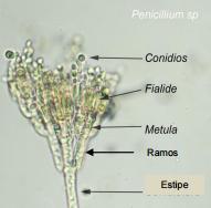 14 Figura 4 Estruturas de Penicillium. Fonte: Damasceno, 2012.