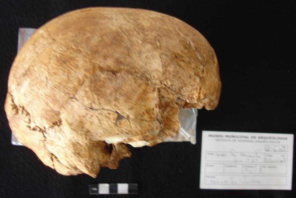 Figura 37- Crânio do indivíduo 92 da sepultura 3 (foto do autor) Como os ossos ilíacos se encontram em boas condições de conservação, é possível efectuar a diagnose sexual.