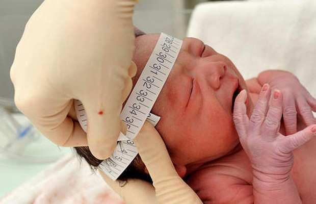 6 de 13 14/03/2016 10:03 Enfermeira mede a cabeça de criança recém-nascida para verificar sinais de microcefalia (Foto: Reprodução/YouTube) Bebês diagnosticados com microcefalia em todo o país vão