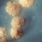 Actinobacteria Mycobacterium: bastonetes aeróbicos não formadores de esporos.