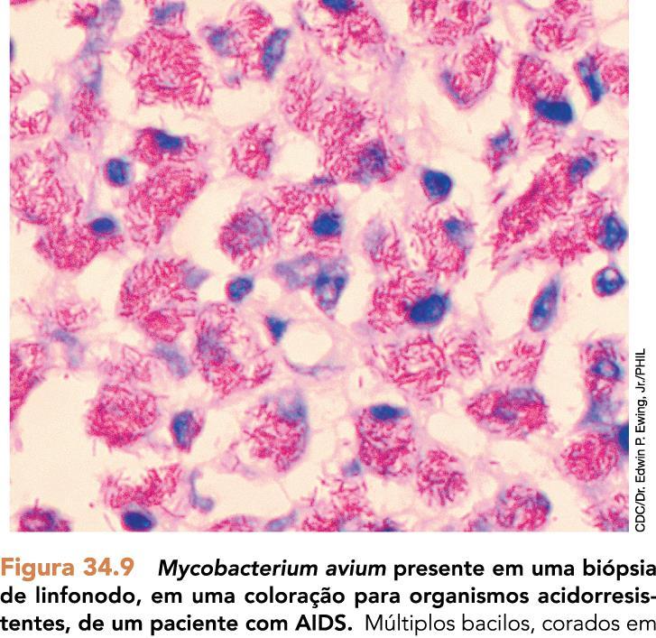 Mycobacterium leprae agente da lepra Nunca foi cultivado em meio artificial. Cultivado em tatus.