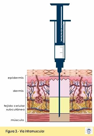 pressão moderada Injetar no máximo 5 ml (Glúteo e Ventro-Glúteo); 3 ml