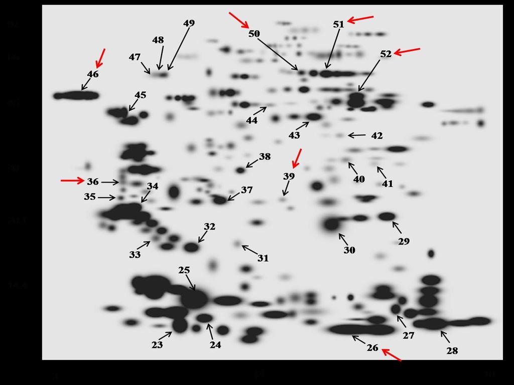 199 Figura 3. Mapa bidimensional das proteínas dos espermatozoides de touros Guzerá gerado pelo aplicativo PDQuest (Bio-Rad, USA), baseado no match set com todos os 13 géis utilizados no estudo.