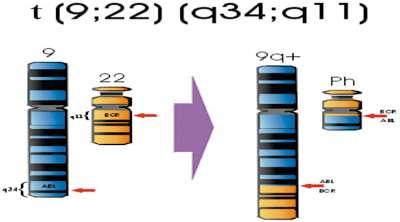 oncogene ABL (abelson oncogene) é transferida para o gene BCR (breakpoint cluster region) no cromossomo 22 e parte do cromossomo 22 é transferida para o cromossomo 9, gerando o BCR- ABL (Figura 1).