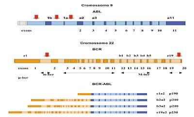 Translocação recíproca entre os cromossomos 9 e 22; (9;22) (q34;q11). Fonte: http://www.unesp.br/prope/projtecn/saude/saude48a.