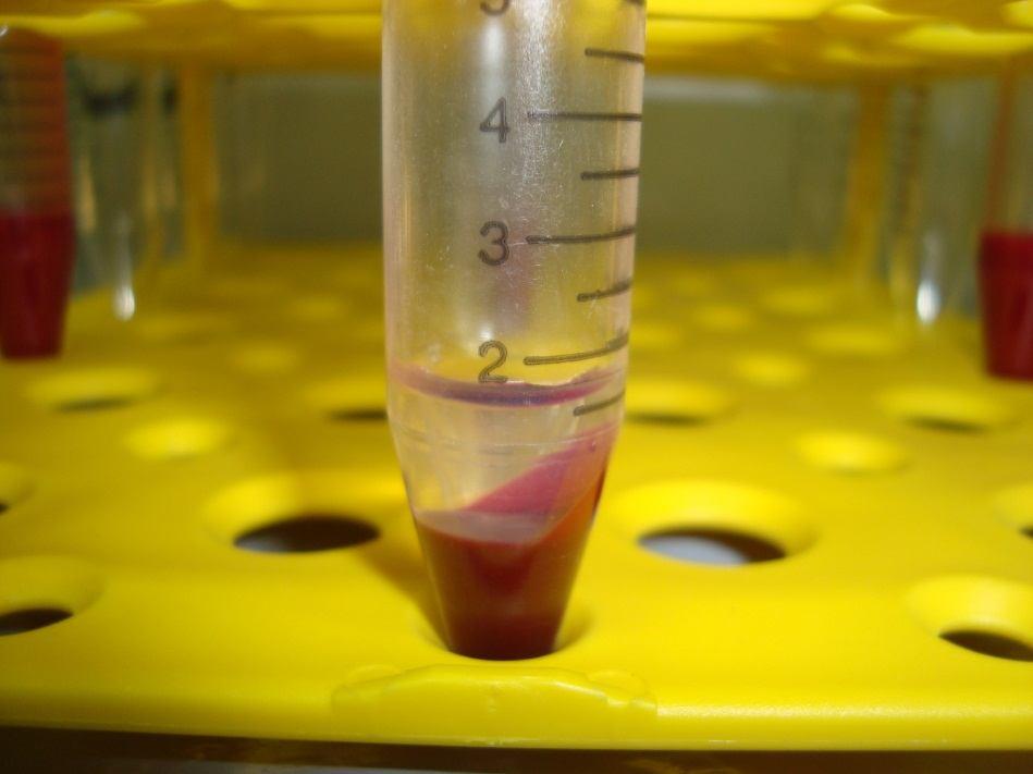 38 de anticoagulante ácido citrato dextrose- A (ACD-A) para evitar a degranulação das plaquetas. Foram transferidos 0,05 ml de sangue para tubos Eppendorf para contagem de plaquetas do sangue total.