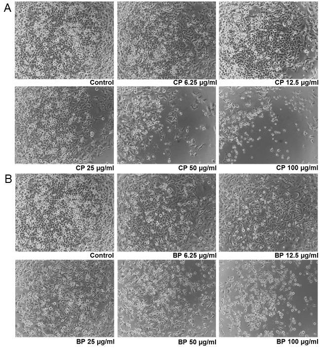 Artigos Científicos Figure 1 HEp-2 cells viability after incubation with Cuban (CP - A) and Brazilian propolis (BP