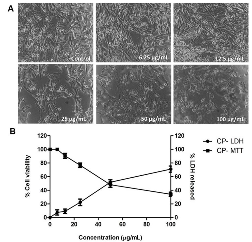 Artigos Científicos Fig.1. Viability and cytotoxicity (%) of MDA MB-231 cells after incubation with CP extract. Cells were treated with various concentrations of Cuban propolis (CP: 6.