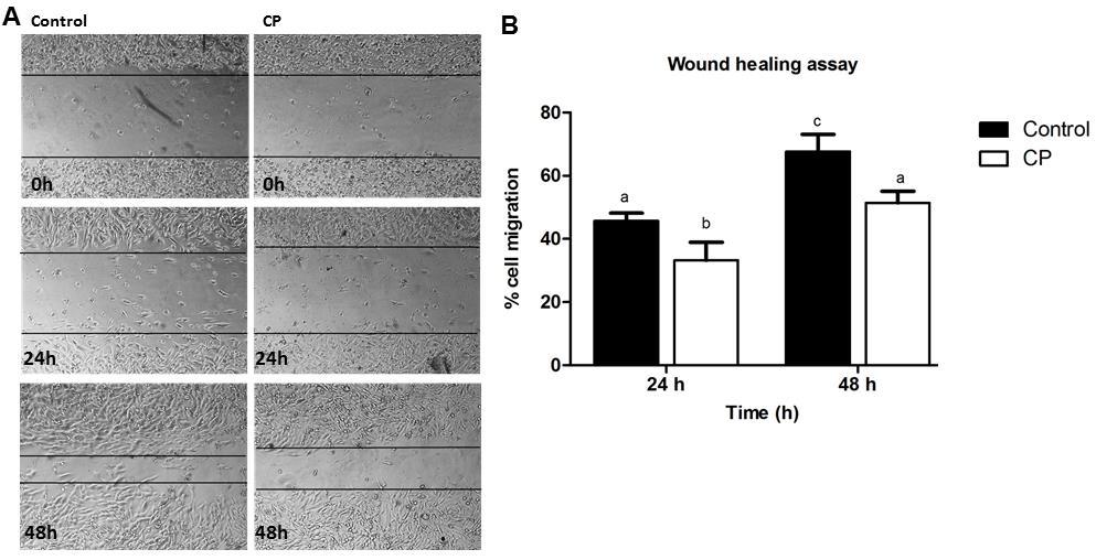 Artigos Científicos Fig 7. CP inhibited cell migration in MDA MB-231 cells. (A) Representative images of wound healing at 0, 24 and 48 h following scratch induction and CP treatment.