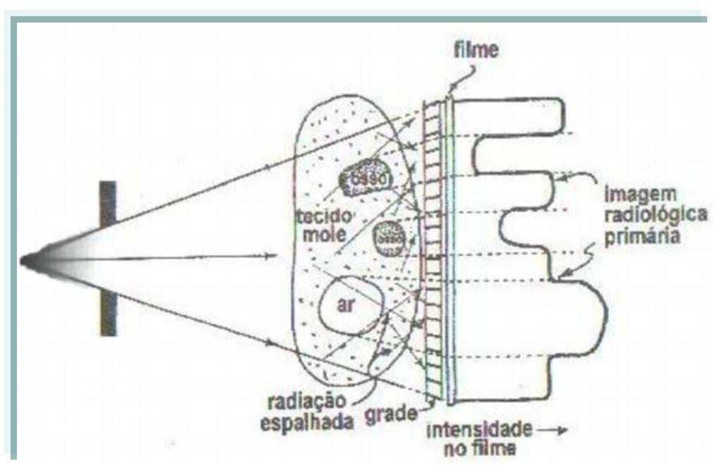 imagem radiográfica