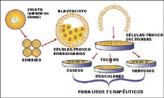 Figura 7: Obtenção de células embrionárias para fins terapêuticos. Fonte: http://www.aggio.jor.br/jornal28/celulas_tronco.