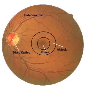 Optic Disc Detection in Retinal Images Using Algorithms Committee with Weighted Voting R. R. V. e Si