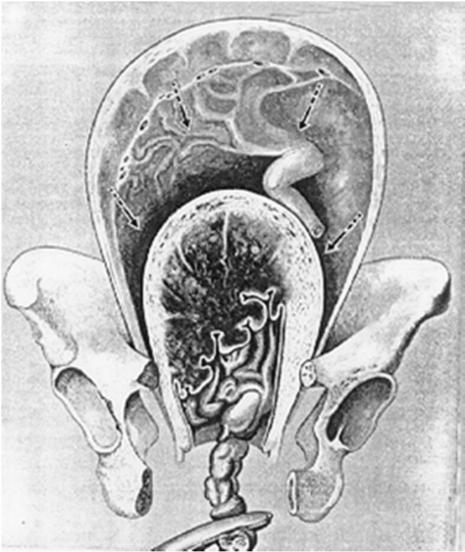 PERÍODO DEQUITAÇÃO início: após a expulsão fetal término: após a saída da placenta pela vagina