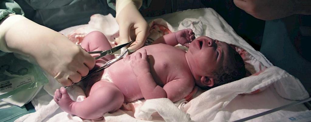 Cuidados após o nascimento Os primeiros cuidados ao recém-nascido (RN) são prestados logo após o