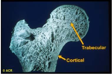 CAPÍTULO 3 Figura 3.2: Tipos de osso: trabecular e cortical (adaptado de [72]). 3.1.