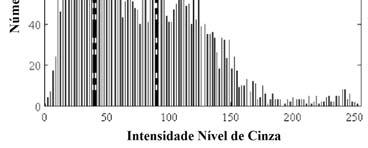 Por outro lado, altos valores de TH darão uma menor quantidade de osso relacionado aos pixels, e consequentemente, subestimação do volume