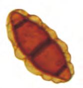 tipo Microthyrium; 108.