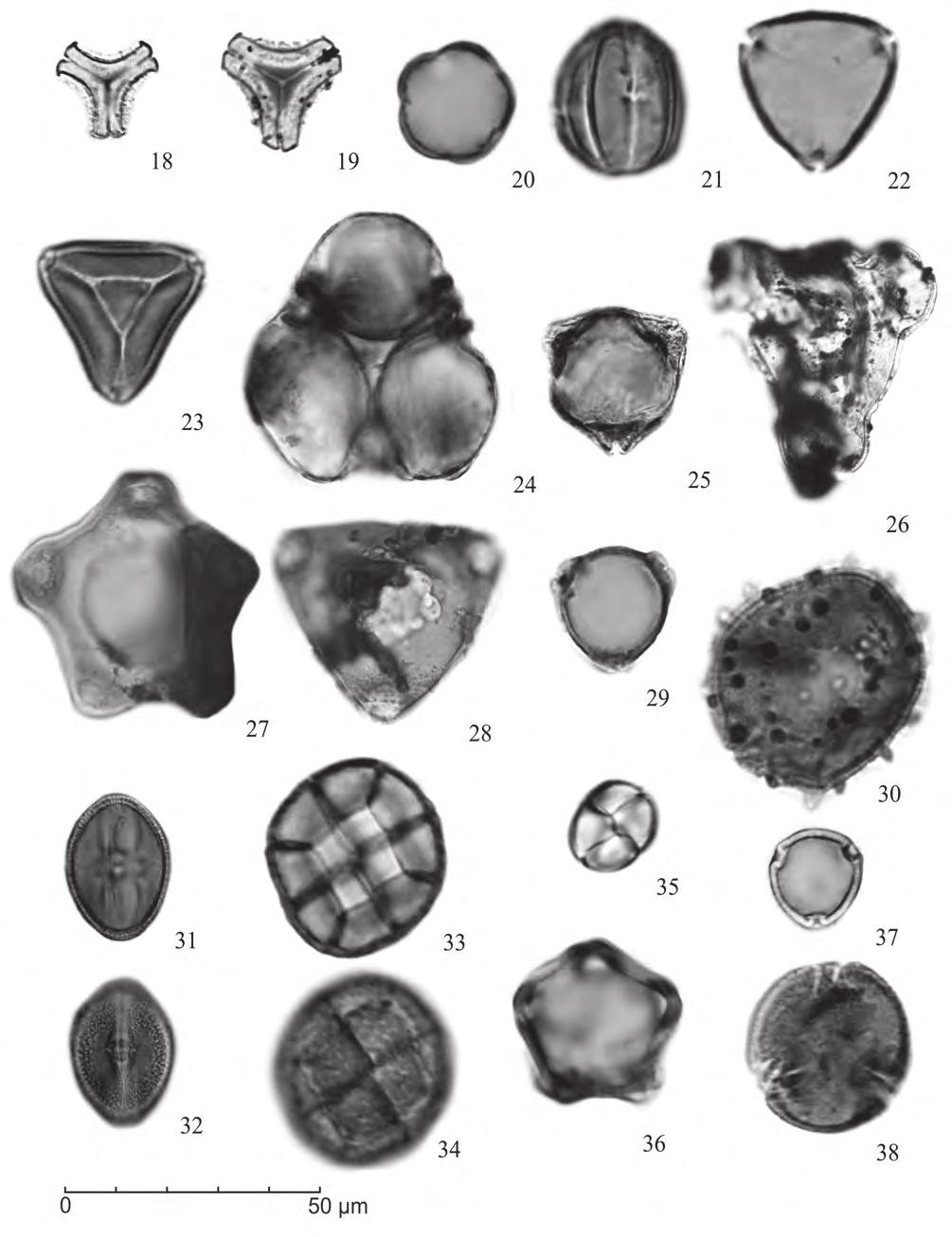 Grãos de pólen de angiospermas do Holoceno (7908±30 anos AP-atual) da Planície Costeira sul-catarinense, Brasil Figura 3. Fotomicrografias grão de pólen de angiospermas: 18.