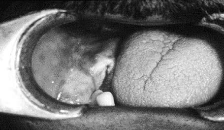 Na maxila, verificou-se a ocorrência de tumor na região de molares esquerda em 3,5% dos casos, seguida da região de molares do lado direito e região anterior, com um caso em cada uma delas.