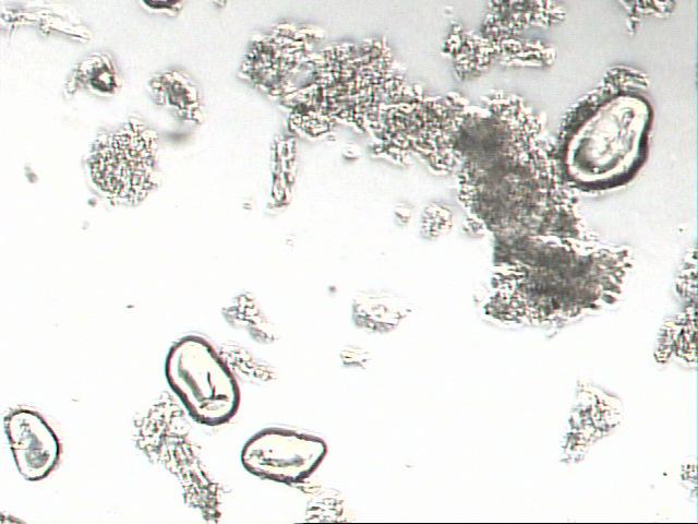 Por meio da análise microscópica dos subprodutos resultantes dos processos enzimáticos apresentados nas Figuras