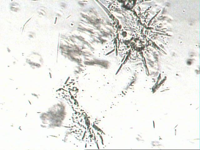 Figura 2 - Caracterização microscópica do resíduo hidrolisado de mandioca.