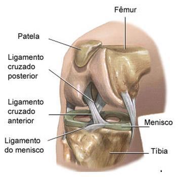 20 associadas com insulto ao joelho e podem ser isoladas ou associadas com lesão ligamentar ou da superfície articular. Esse tipo de ruptura ocorre nos indivíduos mais jovens e ativos.