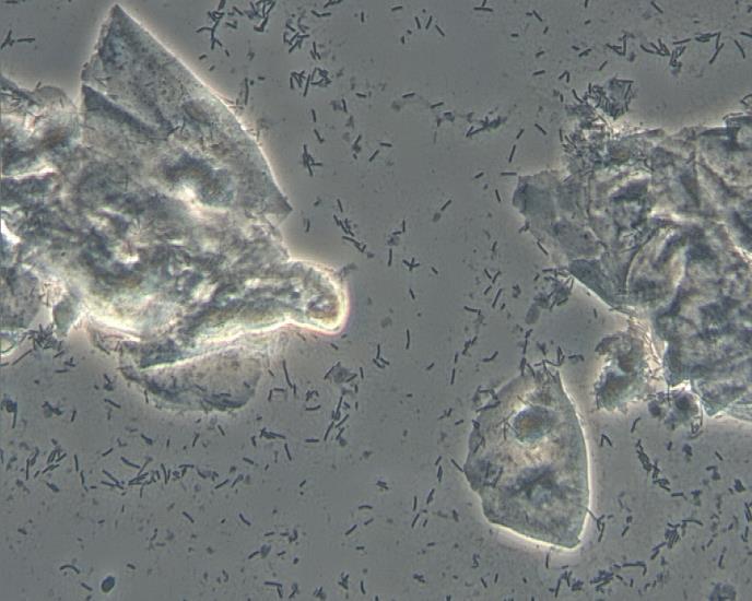 23 FIGURA 3: Padrões de microbiota