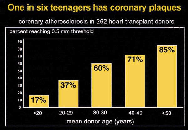 A cada 6 adolescentes um tem placa na coronária Aterosclerose na coronaria de 262