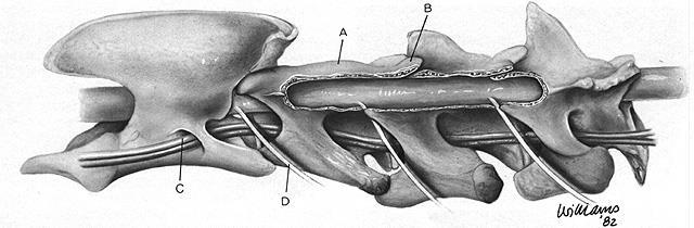 22 A B Figura 5 A) Desenho esquemático da face lateral esquerda da região cervical de um cão. Aspecto final de hemilaminectomia da terceira à quinta vértebras cervicais.
