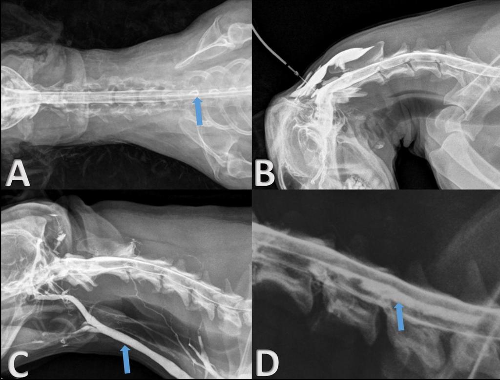 36 C4; C4-C5 (C) e hiperflexão mostrando espondilolistese da terceira e da quarta vértebras cervicais (D). Figura 2 Artefatos visibilizados em mielografia cervical em cadáver de cães.