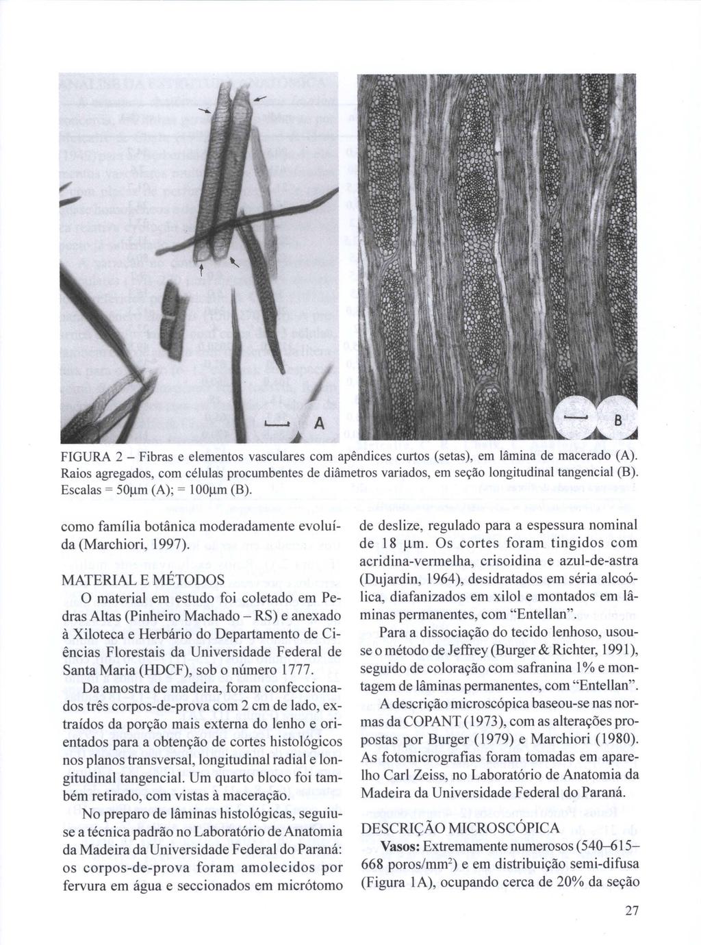 FIGURA 2 - Fibras e elementos vasculares com apêndices curtos (setas), em lâmina de macerado (A). Raios agregados, com células procumbentes de diâmetros variados, em seção longitudinal tangencial (B).