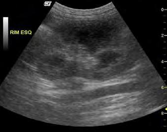 8 Assis (2011) FIGURA 1 Imagem ultrassonográfica renal,