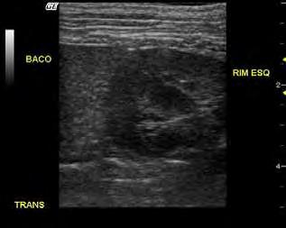 9 Assis (2011) FIGURA 3 Imagem ultrassonográfica renal Modo B exemplificando os planos de exame transversal em um cão.