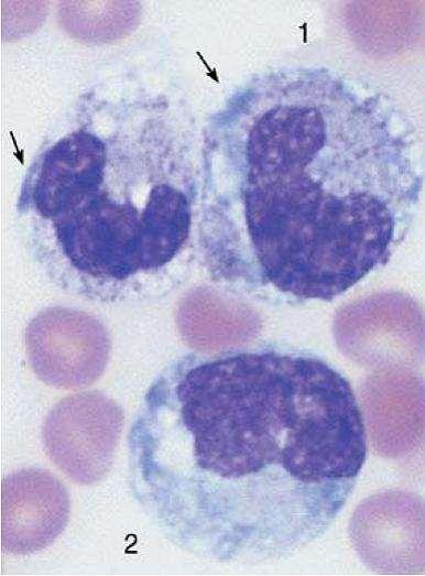 Vacuolização citoplasmática fagocitose de bactérias com grande