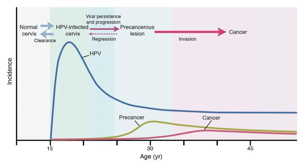 Quando começar fazer o teste de DNA-HPV no rastreamento?