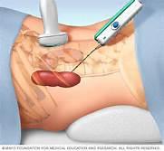 Investigação diagnóstica Imunologia para nefrite lúpica Sorologia para vírus Exames para Mieloma Múltiplo (> 40 anos) Ultrassom