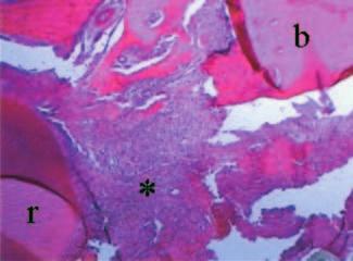 Avaliação histológica No que se refere à avaliação microscópica das lâminas confeccionadas, verificou-se no grupo T um preenchimento de quase todo o defeito pela membrana.