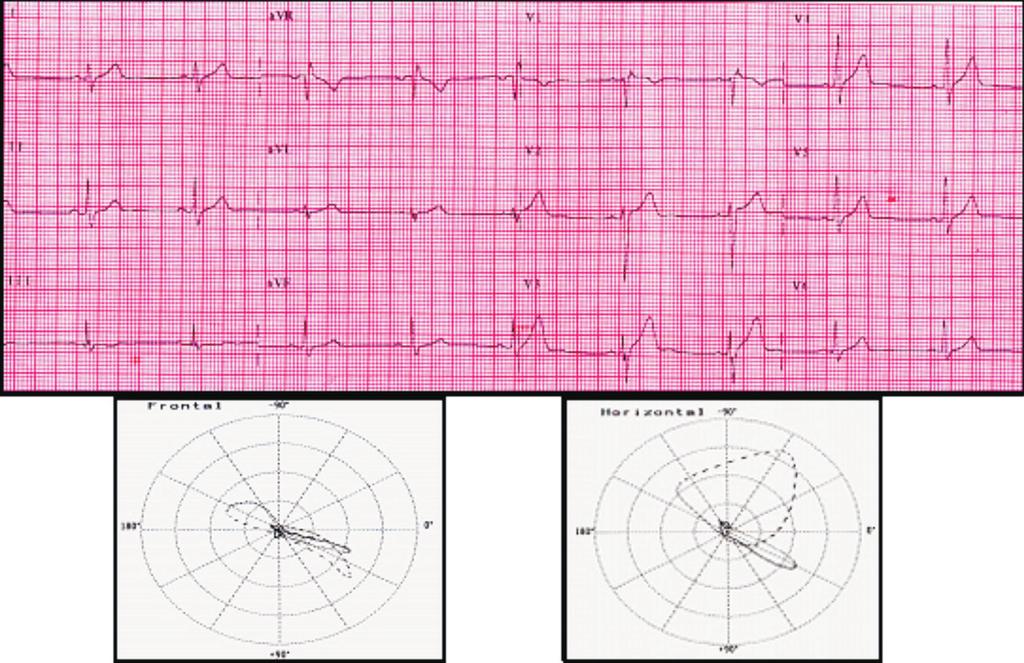 ABC do ECG Caso 1 J.A.N.