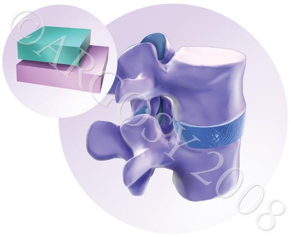 moles (ligamentos, tendões e cápsula).