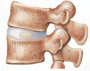 b) Meniscos - Fibrocartilagens que se aderem por intermédio dos seus bordos, à face interna da cápsula,