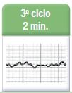 * A cada 2 minutos análise o ritmo cardíaco É FV ou TV sem pulso?