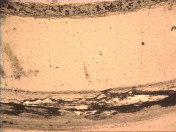 As micrografias óticas das calotes nas esferas de desgaste e pista de desgaste dos filmes correspondentes à figura anterior estão apresentadas na Figura 4.12.