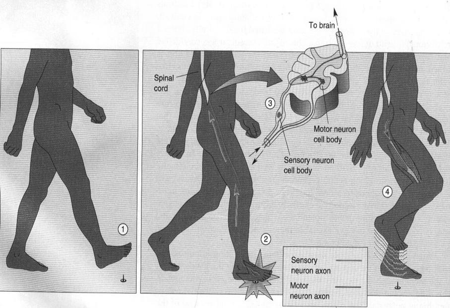 DOR Nociceptiva Dor Somática Ex.: dores ósseas, dores músculo- esqueléticas, etc. Dor Visceral Ex.: câncer de pâncreas, obstrução intestinal, metástase intraperitoneal, etc.