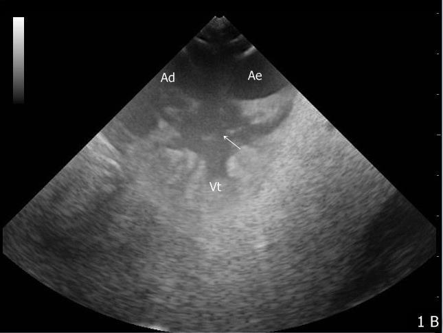 39 A B C D E F Figura5- Imagem ultrassonográfica do coração, tireóide e fígado do jabuti vistos através das janelas cervicais direita e esquerda.