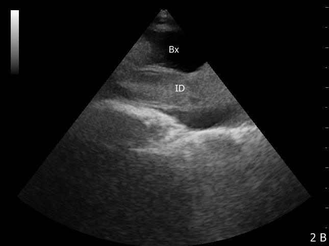 41 A B C D Figura 6- Imagem ultrassonográfica do sistema gastrointestinal do jabuti, vistos através da janela cervical esquerda (estômago) e janelas pré-femorais esquerda e direita (intestino delgado