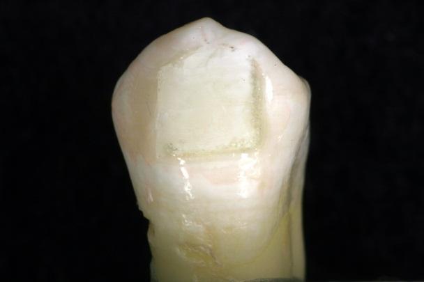 A) Imagem do dente após ensaio de cisalhamento; B) Imagem do