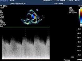 cardioiap.