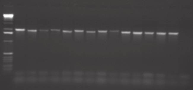 Otimização das técnicas de PCR e RFLP para o gene tbpa de Haemophilus parasuis.