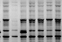 Microssatélites RFLP AFLP PCR